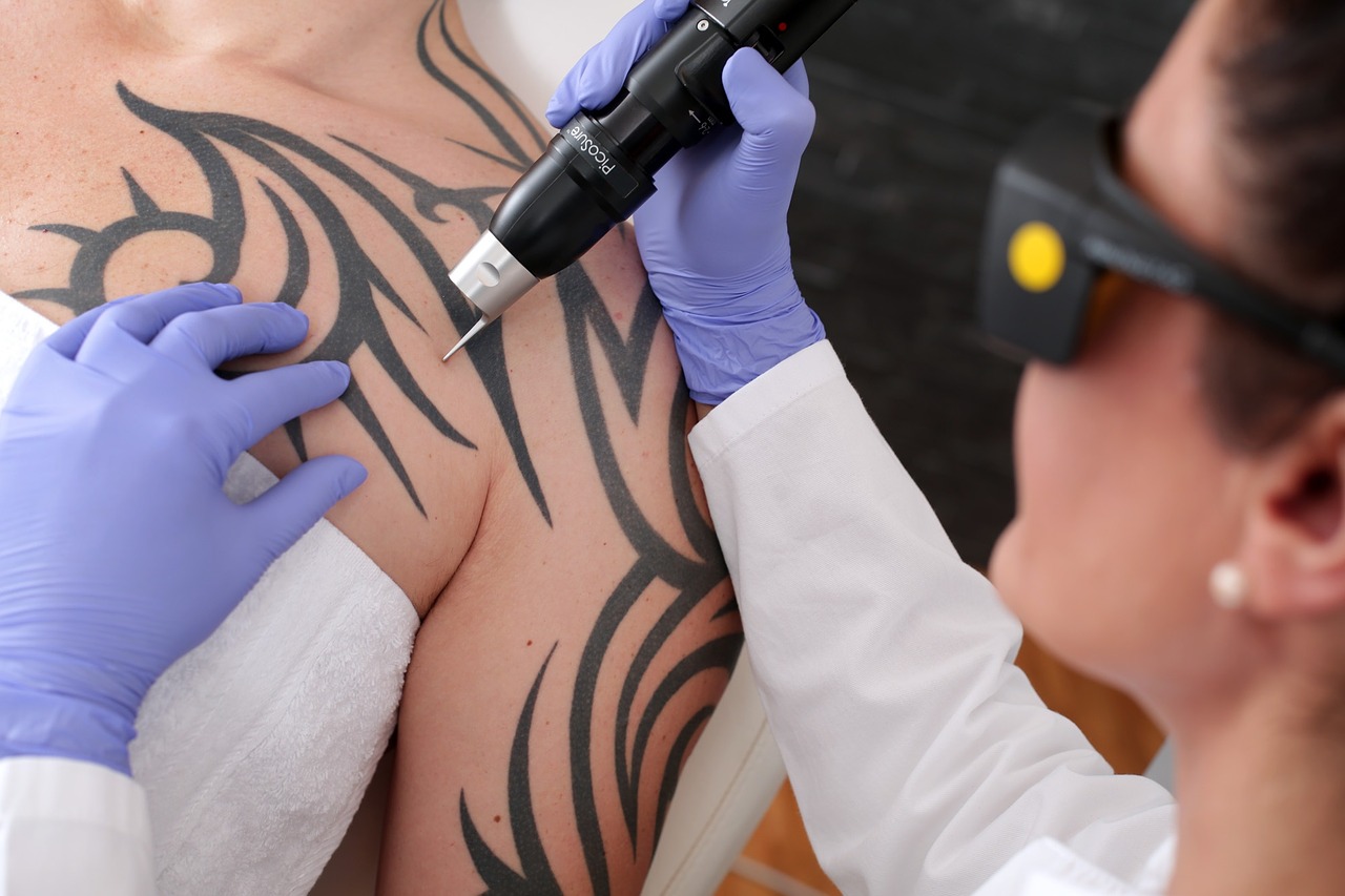 Можно ли делать лазерную эпиляцию на татуировке
