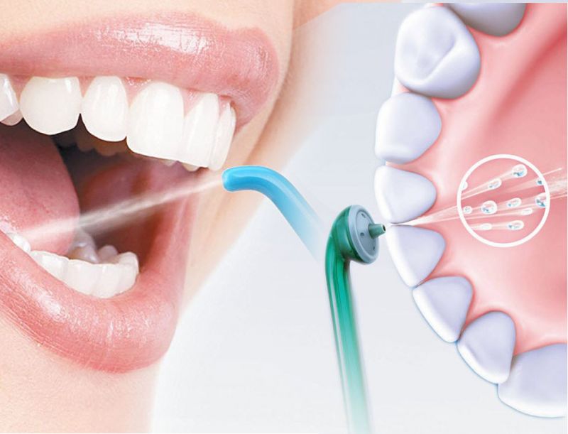 Профессиональная чистка зубов: особенности процедуры