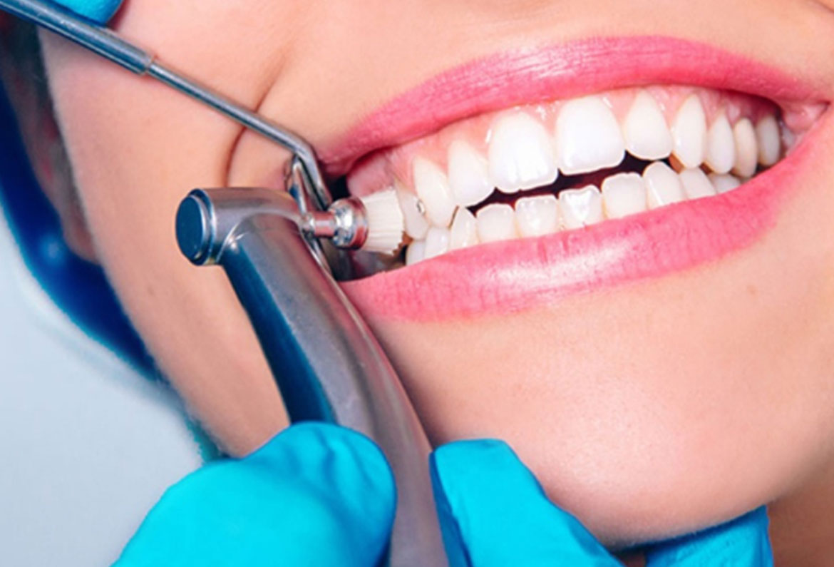 Профессиональная чистка зубов: особенности процедуры