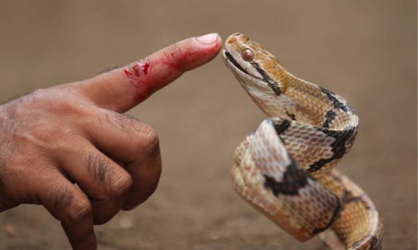 Кошачья змея укусила человеческую руку
